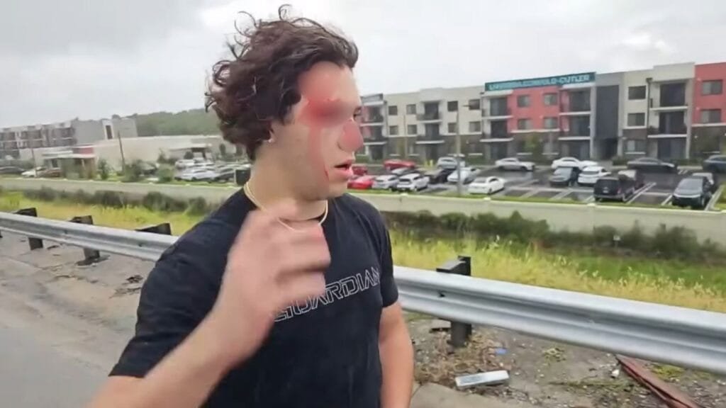 Jack Doherty Cameraman Car Crash